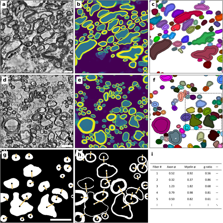Overview of the segmentation approach for electron microscopic data. a, Preprocessed transmission electron microscopic data of human corpus callosum (CC). b, Semantic prediction of the preprocessed data by the trained DenseNet, returning a likelihood of each pixel to belong to either background (violet), axon (teal), or myelin (yellow). c, Post-processed final segmentation. Each instance of a fiber (axon and myelin sheath) is labelled with a different random color. d–f, Analogous to a–c, with transmission electron microscopic data of human superficial white matter (SWM). The dashed region in f is shown in g,h. The measurement of axon (g) and myelination (h) diameters is based on ellipses fitted to each structure. Points show the centroid of each structure, axes show half of the minor axis of the fitted ellipse for the axon (solid line) and myelin (dashed line). i, Measurements (SWM: n = 220,431, CC: n = 163,133) from g, h are used for statistical assessment of local ultrastructure. We treat the short axis (half of which is shown in yellow in g, h) of the fitted ellipse as the actual diameter of each structure. All scale bars are 2 µm.