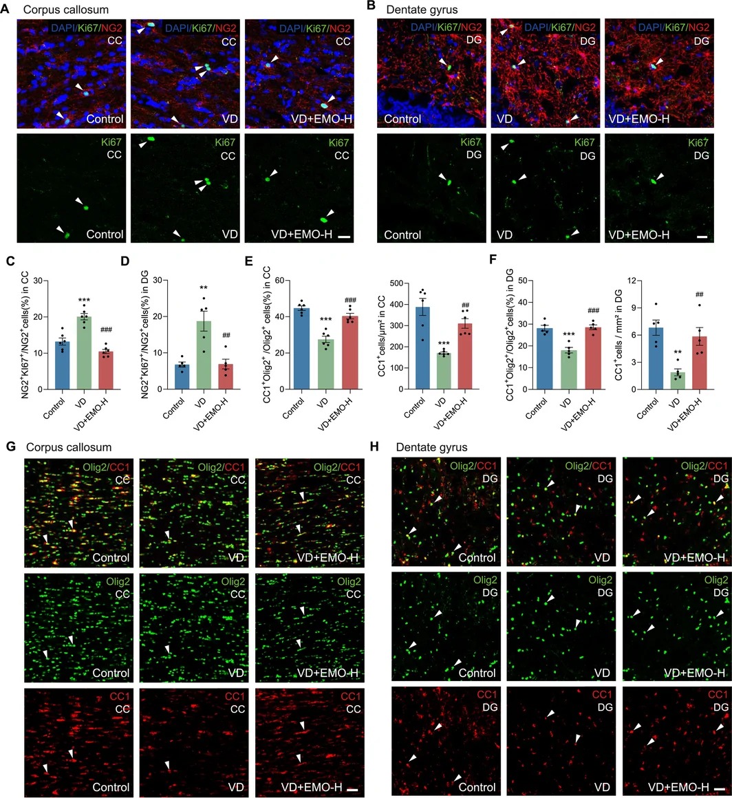 Emodin promotes OL lineage progression in the CC and hippocampal DG in VD rats. (A, B) Representative images of double-staining for NG2 and Ki67 in the CC and DG. DAPI (nuclei, blue), NG2 (OPCs, red), Ki67+ (proliferating cells, green). White arrows indicate NG2+Ki67+ proliferating OPCs. High-magnification images were taken from the CC and DG separately. Scale bar: 20 um. (C, D) The ratio of the number of NG2+Ki67+ cells to that of NG2+ cells (%) in the CC and the DG. (E, F) The ratio of the number of Olig2+CC1+ cells to that of Olig2+ cells (%) and average number of CC1+ cells per mm2 in the CC and DG regions. (G, H) Representative images of double-staining for Olig2 and CC1 in the CC and DG of the hippocampus. DAPI (nuclei, blue), Olig2 (oligodendrocyte lineage cells, green), CC1 (mature OLs, red). White arrows indicate Olig2+CC1+ mature OLs. (**p < 0.01, ***p < 0.001 vs. Control; ##p < 0.01, ###p < 0.001 vs. VD. Data are represented as mean +/- SEM, n = 5-6 rats per group, 3 brain slices per animal; CC, corpus callosum; DG, dentate gyrus).
