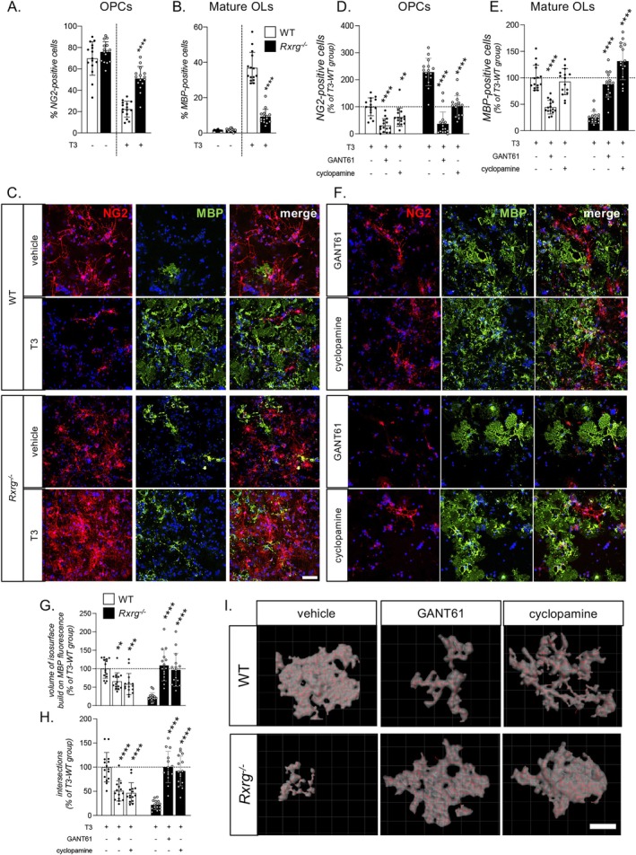 OPC differentiation and maturation are impaired in Rxrg-/- cultures through a Shh-dependent mechanism. (A, B) Graphs show the percentage of OPCs (A, NG2-positive cells) and mature oligodendrocytes (B, MBP-positive cells) in WT and Rxrg-/- cultures at 6 DIVs after exposure to T3 or vehicle. (C) Representative pictures of OPCs (NG2-positive cells) and mature oligodendrocytes (MBP-positive cells) in WT and Rxrg-/- cultures. (D) Percentage of MBP-positive cells in WT and Rxrg-/- cultures treated with cyclopamine or vehicle, alone or in combination with T3. Scale bar 100 um. (E, F) Expression of Mbp at mRNA (E) and protein (F) level in WT cultures treated with cyclopamine or SAG compared to untreated cells.