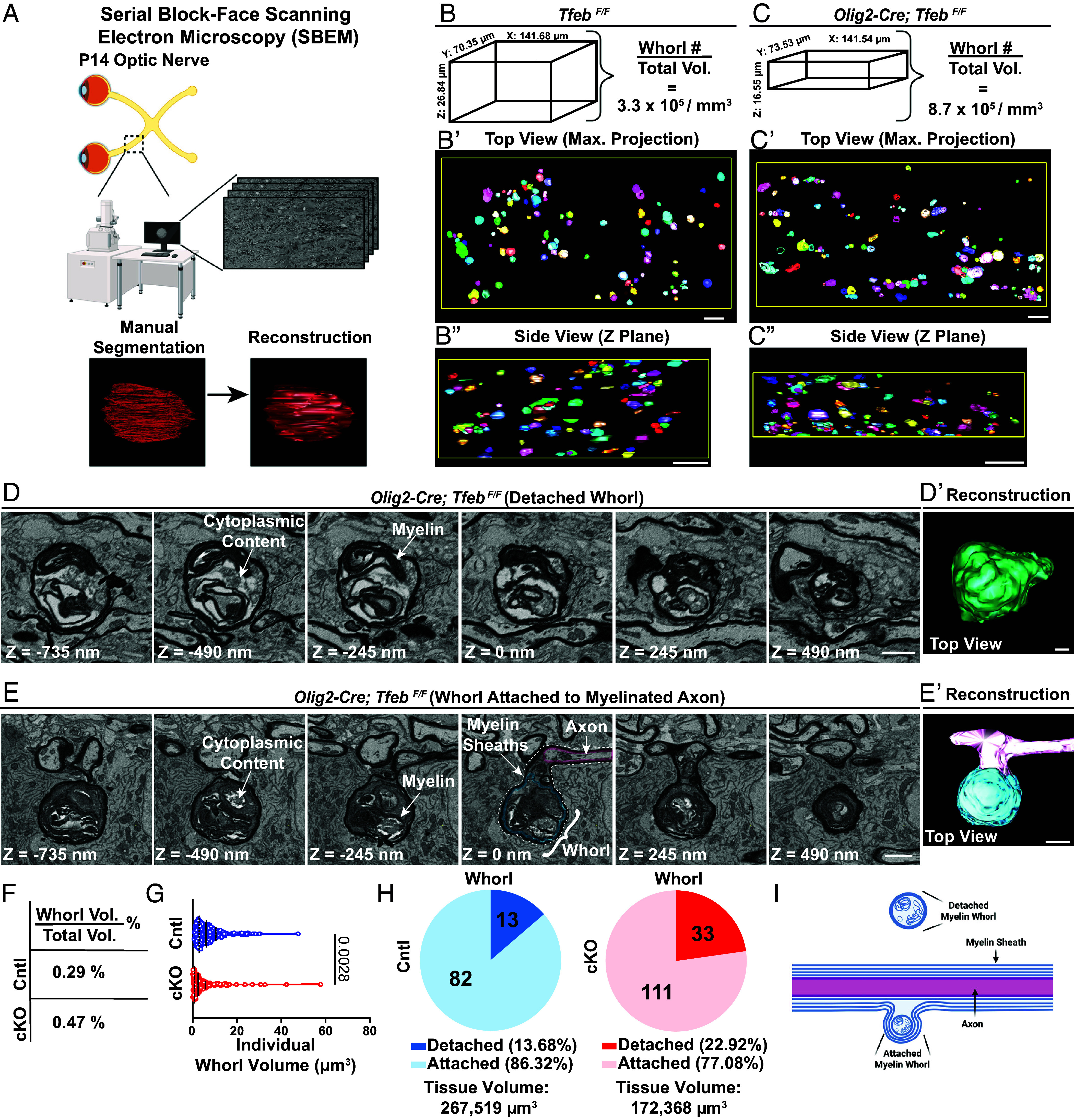 The majority of myelin whorls are located within oligodendrocyte cytosol and are associated with myelinated axons, as revealed by SBEM. (A) Workflow for SBEM imaging and analysis of P14 optic nerves, including tissue preparation, SBEM imaging (Z-step size: 35 nm), manual segmentation, and 3D reconstruction. (B-C'') SBEM reconstruction of P14 TfebF/F (B-B'') and Olig2-Cre; TfebF/F optic nerves (C-C''). (B) and (C) show the SBEM volume sizes and whorl densities from TfebF/F and Olig2-Cre; TfebF/F optic nerves, respectively. The reconstructed myelin whorls can be visualized by maximum projections from the top view (B' and C') and side view (B'' and C'') in TfebF/F (B' and B'') and Olig2-Cre; TfebF/F optic nerves (C' and C''). (D and D') Representative SBEM sections along the z-axis of a detached whorl (D), and its reconstruction (D') in the Olig2-Cre; TfebF/F optic nerve. (E and E') Representative SBEM sections along the z-axis of a whorl associated with a myelinated axon (E), and its reconstruction (E') in the Olig2-Cre; TfebF/F optic nerve. The myelin whorl is outlined in blue, while the myelinated axon is outlined in yellow. Scale bar, 5 um (D and E).