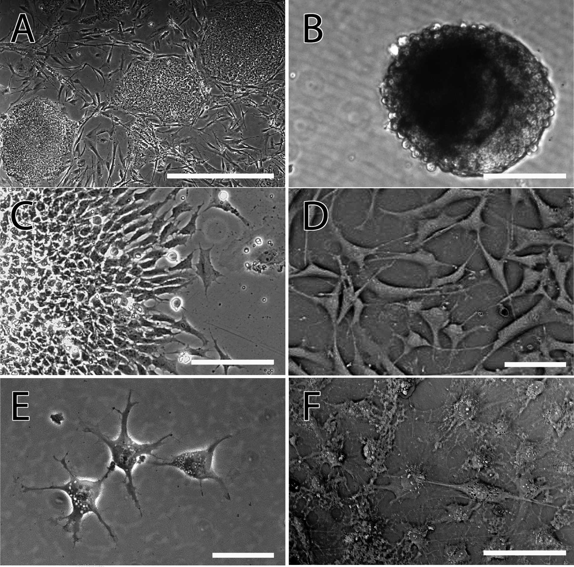 Bright field microscopy showing the stages of oligodendrocyte differentiation from human iPSCs (BC1 line). The progression from OPC to immature and then mature oligodendrocyte can be followed by the elaboration of processes and flattening of the cell body.