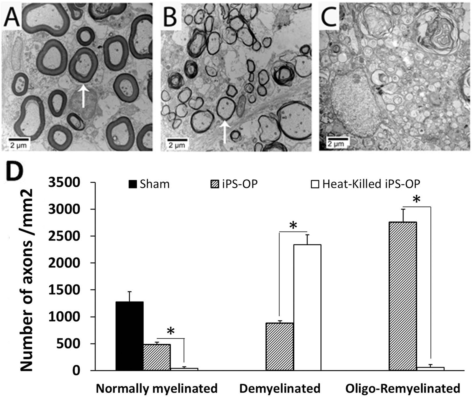 TEM of transverse sections of rat spinal cord showing remyelination of spared axons by iPS-derived OPCs after contusive SCI. Thin remyelinating sheaths are visible around axons.