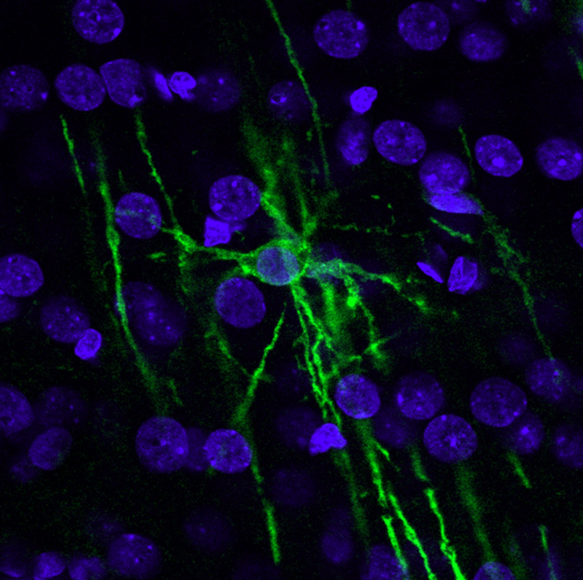 Confocal image of oligodendrocytes in adult mouse brain stained with the Rip antibody (green). Cell nuclei are counterstained with DAPI (blue). The branching processes characteristic of myelinating oligodendrocytes are visible.