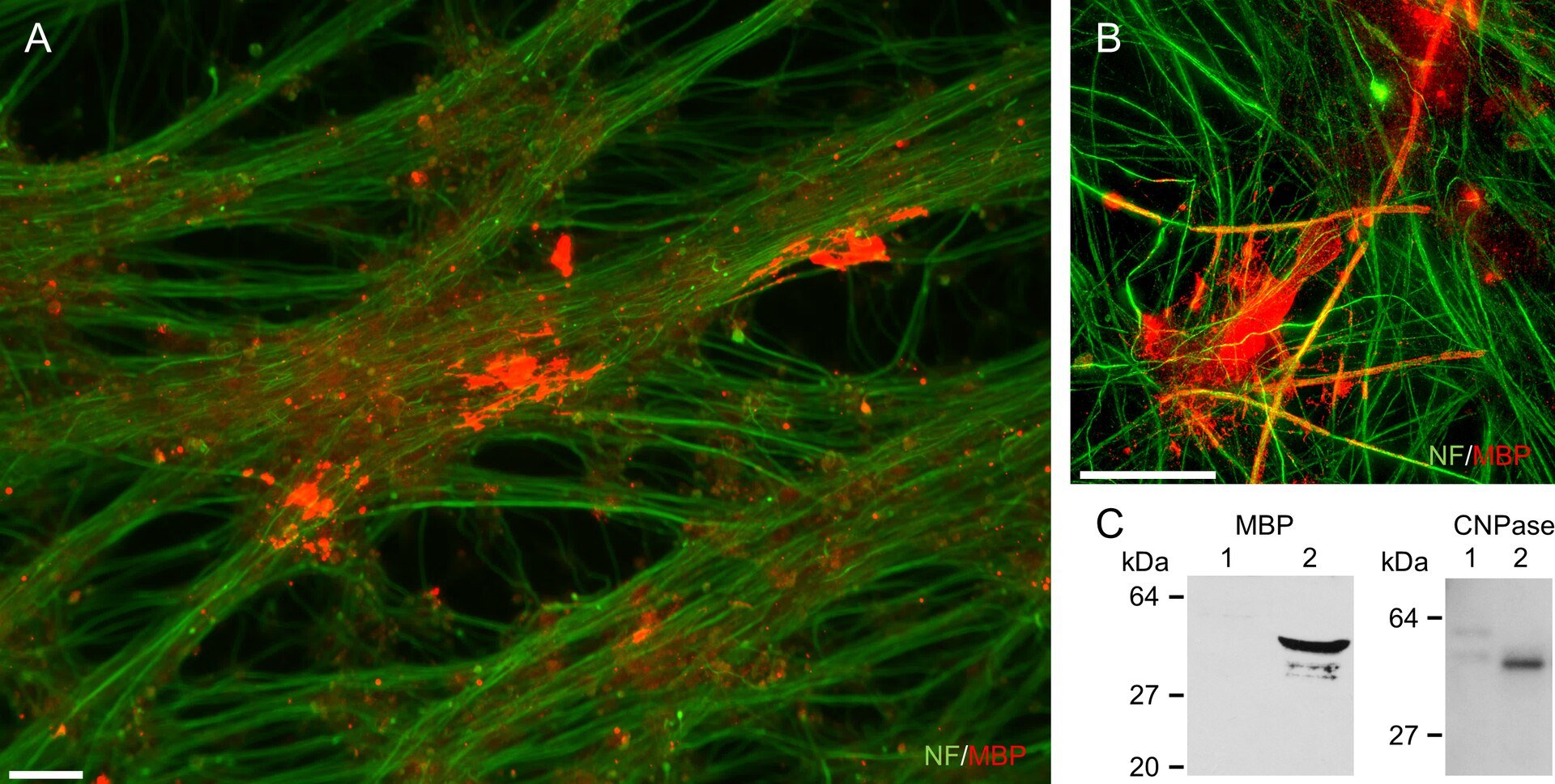 Monkey ESC-derived OPCs (CMK6SFF) co-cultured with rat DRG neurons demonstrate myelinogenic potency in vitro. MBP-positive (red) myelin segments wrap along axons.